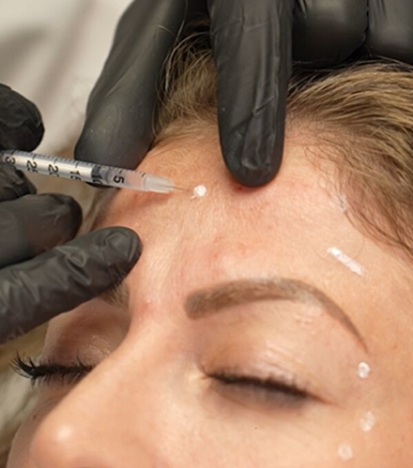 Minimal-invasive Verfahren zur Verjüngung des Aussehens – beispielsweise Injektionen von Botulinumtoxin – sind beliebt, zunehmend auch schon bei jüngeren Personen. Bild: Skinmed AG