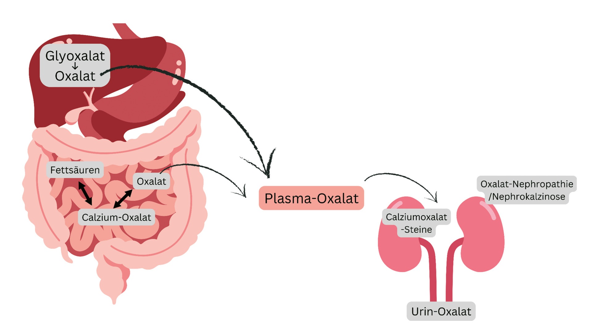 Abb. 2: Oxalatstoffwechsel: Es sind verschiedene Organe somit am Oxalatstoffwechsel beteiligt: (1) In der Leber ist Oxalat ein Endprodukt des Glyoxalatstoffwechsels. (2) Im Darm wird aus der Nahrung stammendes Oxalat resorbiert. (3) Das im Blut zirkulierende Oxalat wird über die Niere ausgeschieden, was bei erhöhten Konzentrationen zu Calciumoxalat-Nierensteinen, kortikomedullärer Nephrokalzinose und Oxalat-Nephropathie führen kann [24].